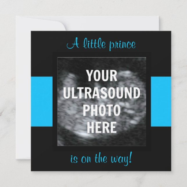 Boy Baby Customised Ultrasound Photo Template (Front)