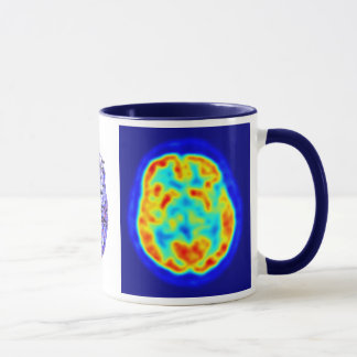 Brain image mug