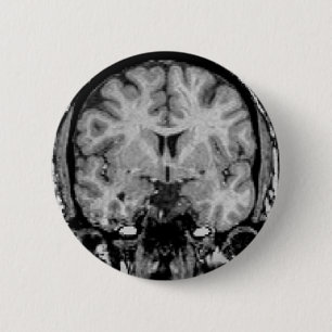 Brain MRI, coronal slice 6 Cm Round Badge