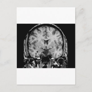Brain MRI, coronal slice Postcard