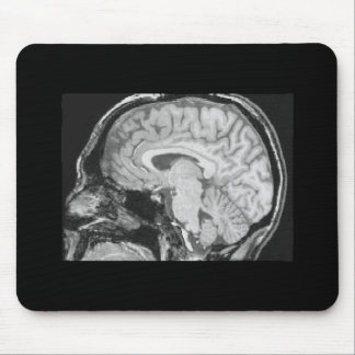 Brain MRI Mouse Pad