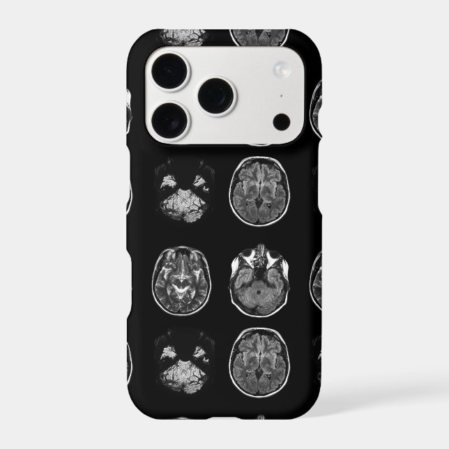 Brain MRI scan (Back)