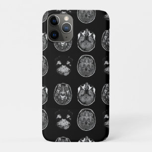 Brain MRI scan Case-Mate iPhone Case