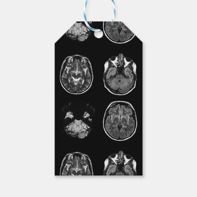 Brain MRI scan Gift Tags (Front)