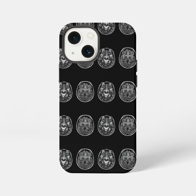 Brain mri scan iPhone case (Back)