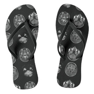 Brain MRI scan Jandals