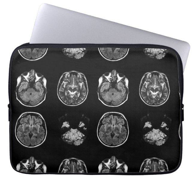 Brain MRI scan Laptop Sleeve (Front)
