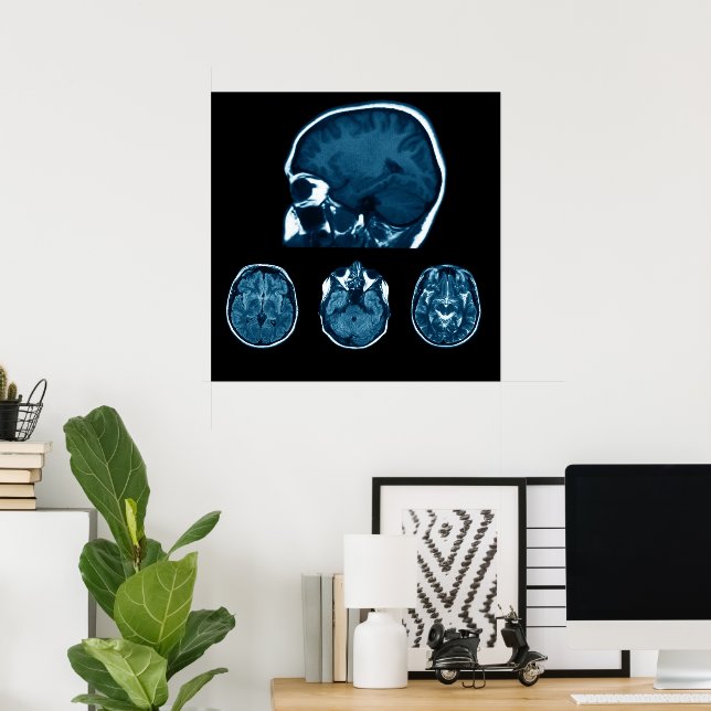 Brain Mri scan Poster (Home Office)