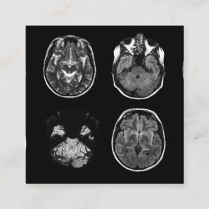 Brain MRI scan Square Business Card