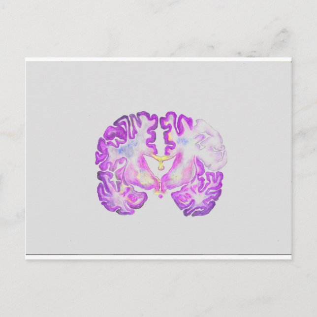 Brain Postcard (Front)