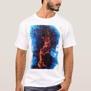 Brain Scan T-Shirt