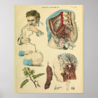Brain Surgery Head Anatomy Art Doctor Print