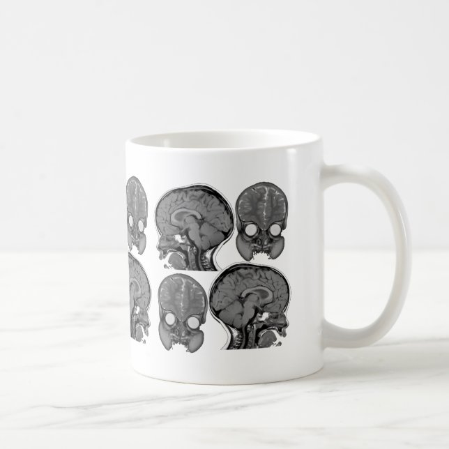 BRAINS! (MRI) COFFEE MUG (Right)
