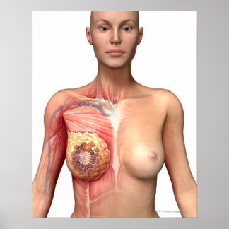 Breast cancer poster