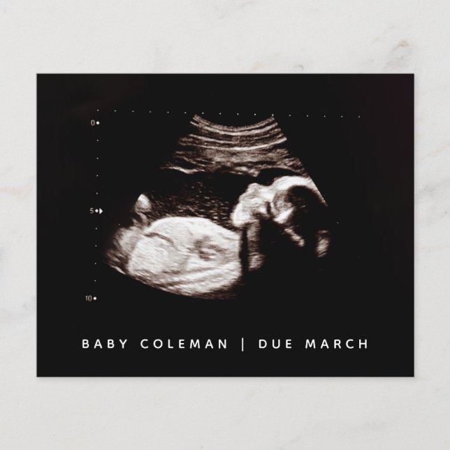 Budget Pregnancy Baby Sonogram Ultrasound Photo (Front)