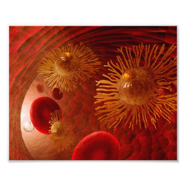 Cancer metastasis poster (Front)