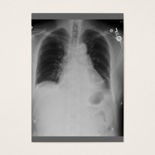 Cardiac Surgery ~ ATC (Front)