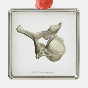 Cervical Vertebra Metal Tree Decoration