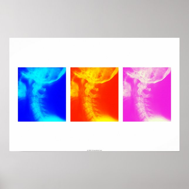 Cervical X-ray Chiropractic poster 2 (Front)