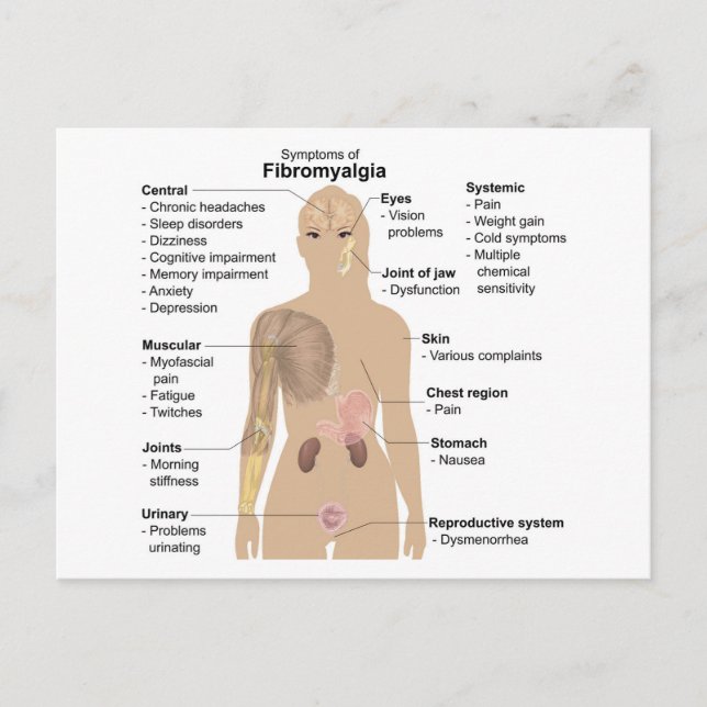 Chart Common Signs and Symptoms of Fibromyalgia Postcard (Front)
