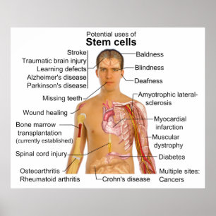 Chart of Potential Uses for Stem Cell Treatments
