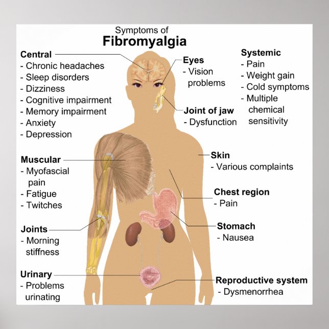 Chart of the Symptoms of Fibromyalgia (Front)