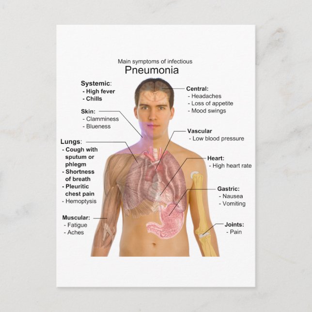 Chart of the Symptoms of Pneumonia Postcard (Front)