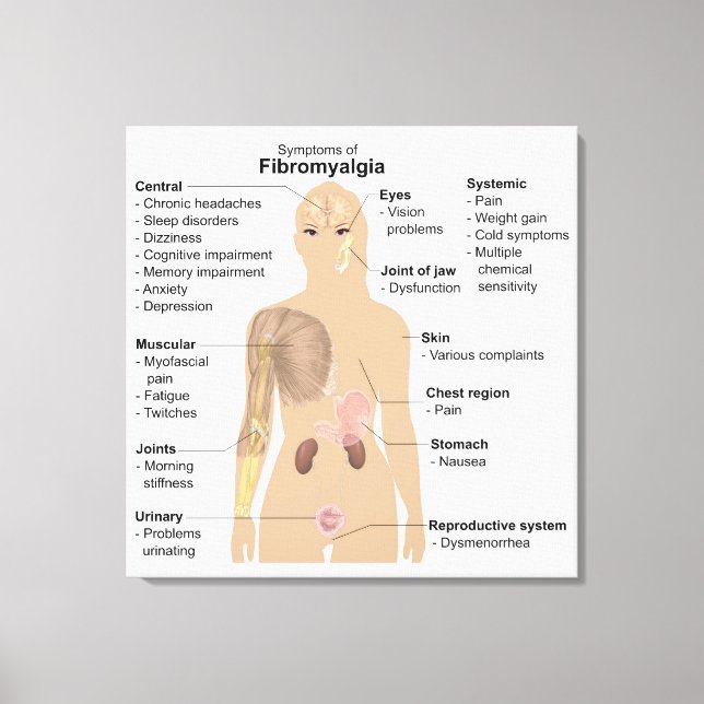 Chart Signs Symptoms Fibromyalgia Canvas Print (Front)