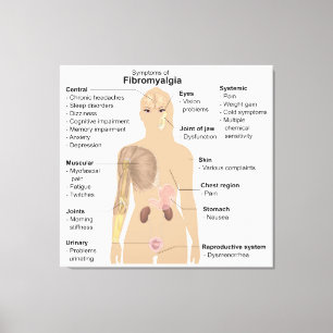 Chart Signs Symptoms Fibromyalgia Canvas Print