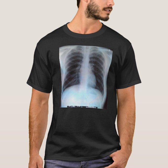 Chest X Ray T-Shirt (Front)