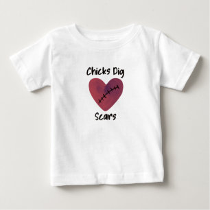 Chicks Dig Scars Baby T-Shirt