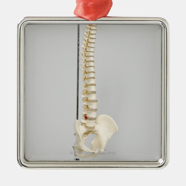 Chiropractic skeleton metal tree decoration (Front)
