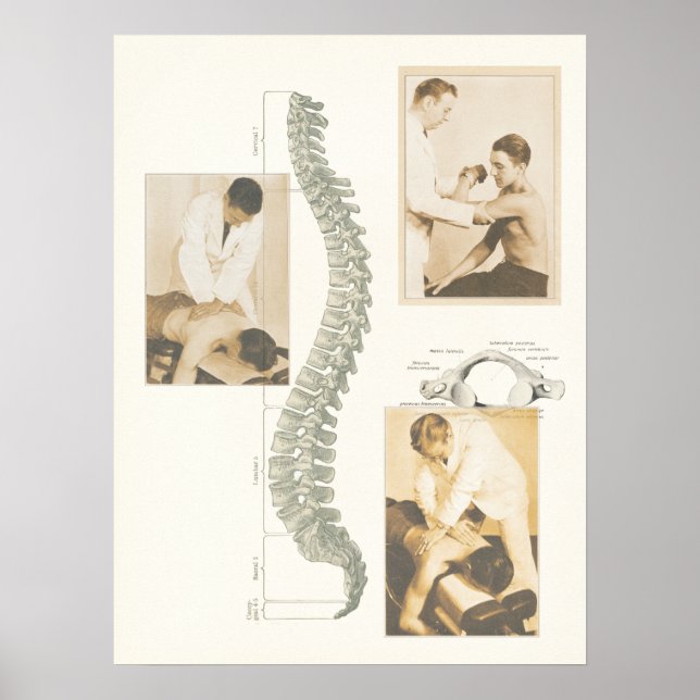 Chiropractic Spinal Adjustment Poster (Front)