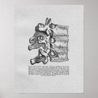 Chiropractic Vertebral Subluxation Vintage Print