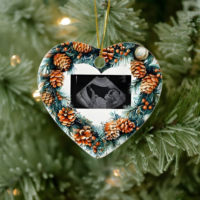 Christmas Pregnancy Ultrasound  Baby On The Way  Ceramic Tree Decoration (Creator Uploaded)