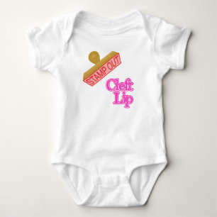 cleft lip baby bodysuit