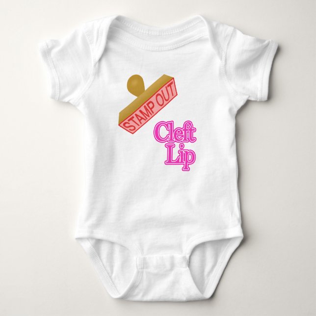 cleft lip baby bodysuit (Front)