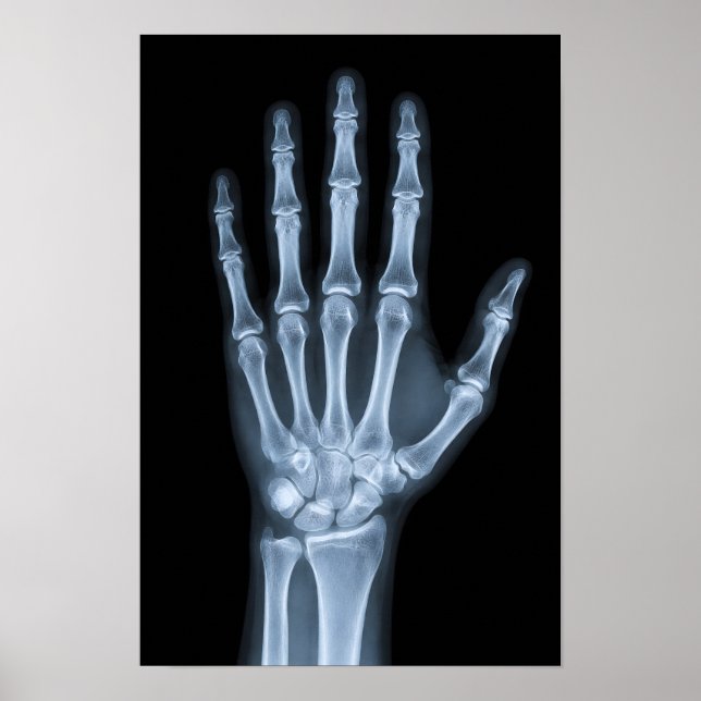 Clinical X-Ray Hand Poster (Front)