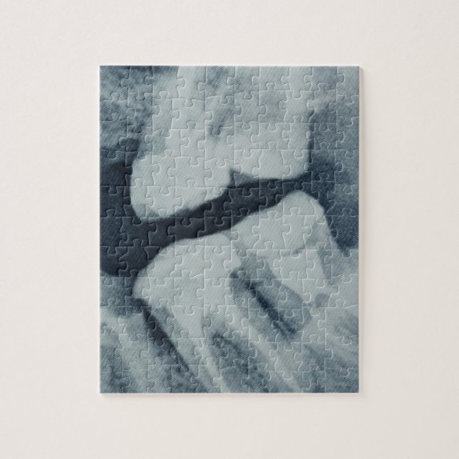 Close-up of a dental X-Ray Jigsaw Puzzle (Vertical)