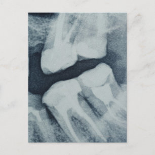 Close-up of a dental X-Ray Postcard