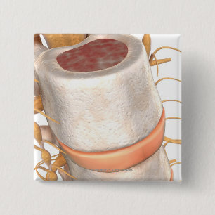 Close up of an invertebral disc in the spine 15 cm square badge