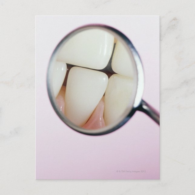 Close-up of teeth reflected in dental mirror postcard (Front)
