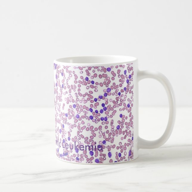 Coffee Mug- CLL Blood Pattern Mug (Right)
