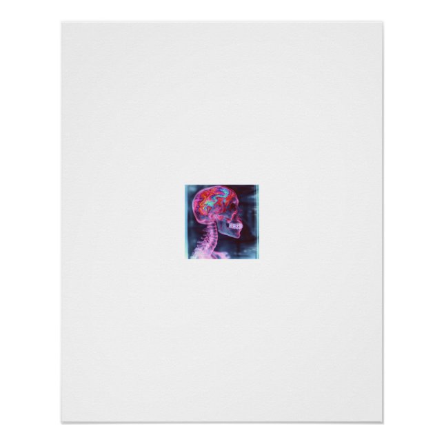 Colourful X-Ray Skull Psychedelic Brain Poster (Front)