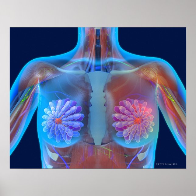 Computer artwork representing breast cancer, poster (Front)
