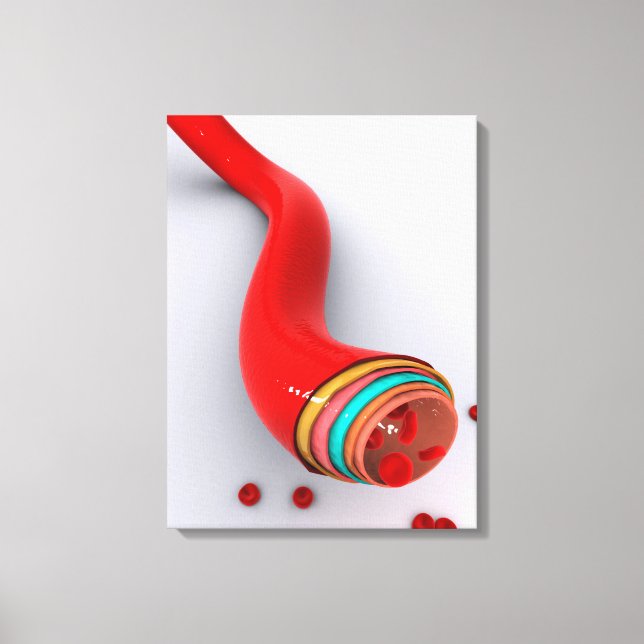 Conceptual Image Of A Blood Vessel Canvas Print (Front)