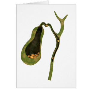 Conceptual Image Of Gallstones Inside Gall
