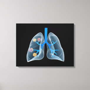 Conceptual Image Of Human Heart 4 Canvas Print