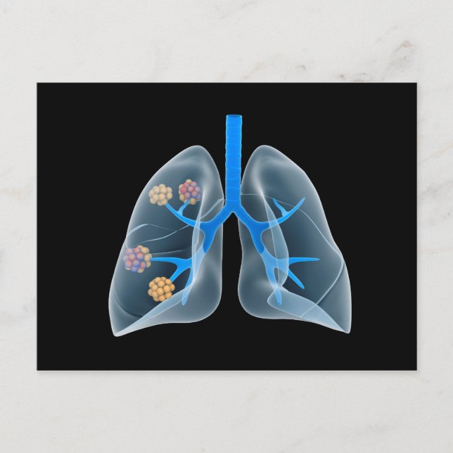 Conceptual Image Of Human Heart 4 Postcard (Front)