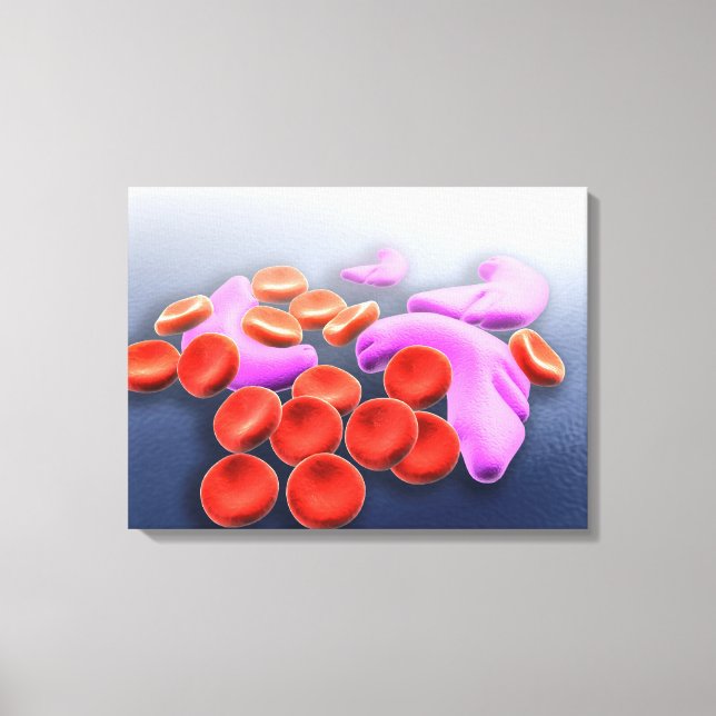 Conceptual Image Of Sickle Cell Anaemia Canvas Print (Front)